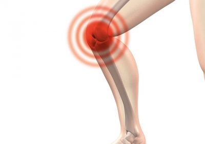 Arthrose du genou : un peu d’activité physique fait déjà beaucoup